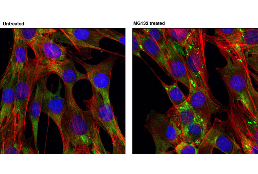 Confocal immunofluorescent analysis of C2C12 cells, untreated or treated with MG-132 (10 μg/mL for 3 hours), using FMRP Antibody (green). Actin filaments were labeled with DY-554 phalloidin (red). Blue pseudocolor = DRAQ5 ® #4084 (fluorescent DNA dye).