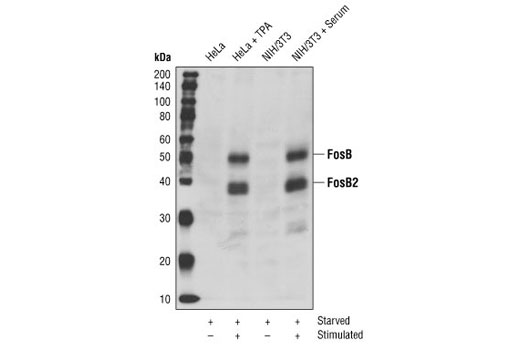 Western blot analysis of extracts from HeLa cells serum-starved overnight and TPA-stimulated for 4 hours or NIH/3T3 cells serum-starved overnight and serum-stimulated for 4 hours, using FosB Antibody.