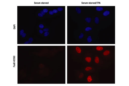 Immunofluorescent analysis of paraformaldehyde-fixed HeLa cells starved overnight (left panels) and stimulated for 4 hours with TPA (right panels). Cells were stained with DAPI (upper panels) and analyzed by IF using FosB Antibody (lower panels).