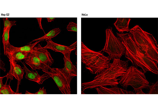 Confocal immunofluorescent analysis of Hep G2 (left) and HeLa (right) cells using FoxA2/HNF3β (D56D6) XP ® Rabbit mAb (green). Actin filaments were labeled with DY-554 phalloidin (red).