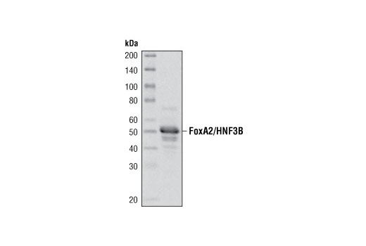 Western blot analysis of extracts from HepG2 cells using FoxA2/HNF3β Antibody.