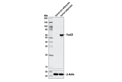 Western blot analysis of extracts from human pre-adipocytes and human adipocytes using FoxC2 (D4D4) Rabbit mAb (upper) or β-Actin (D6A8) Rabbit mAb #8457 (lower).