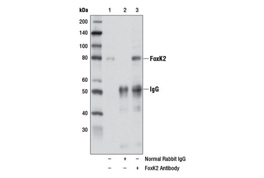 Immunoprecipitation of FoxK2 from PANC-1 cell extracts using Normal Rabbit IgG #2729 (lane 2) or FoxK2 Antibody (lane 3). Lane 1 is 10% input. Western blot analysis was performed using FoxK2 Antibody.