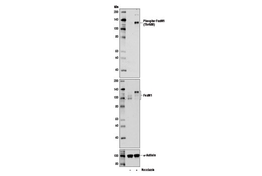 Western blot analysis of extracts from HeLa cells, untreated (-) or synchronized in mitosis with Nocodazole #2190 (100 ng/ml, 16 hr; +), using Phospho-FoxM1 (Thr600) (D9M6G) Rabbit mAb (upper), FoxM1 (D12D5) XP ® Rabbit mAb #5436 (middle), and α-Actinin (D6F6) XP ® Rabbit mAb #6487 (lower).