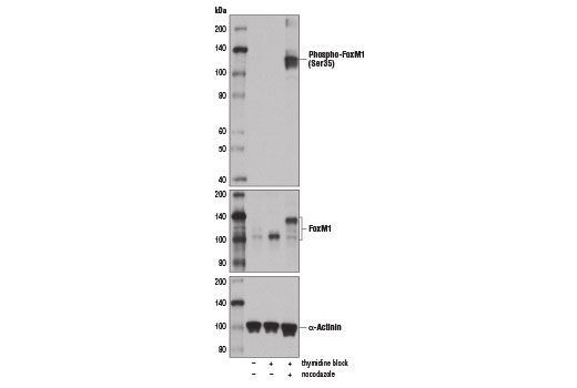 Western blot analysis of extracts from HeLa cells that are untreated (-), synchronized in S-phase by double thymidine block (2 mM, 18 hr; +), or synchronized in mitosis with double thymidine block followed by release into fresh medium containing Nocodazole #2190 (100 ng/ml, 18 hr; +), using Phospho-FoxM1 (Ser35) Antibody (upper), FoxM1 (D12D5) XP ® Rabbit mAb #5436 (middle) or α-Actinin (D6F6) XP ® Rabbit mAb #6487 (lower).