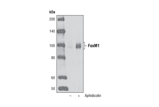 Western blot analysis of extracts of HeLa cells, synchronized at the G1/S border by aphidicolin treatment (2 μM, 24 hours), using FoxM1 (D12D5) XP ® Rabbit mAb.