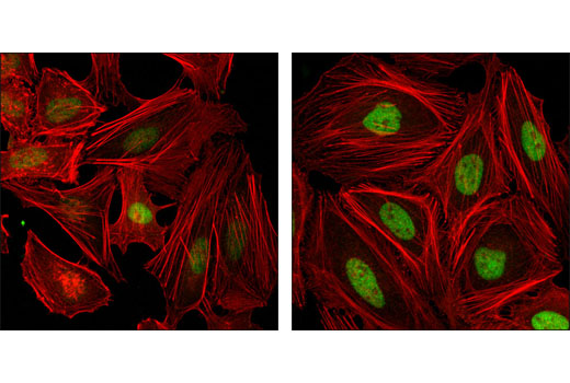 Confocal immunofluorescent analysis of HeLa cells, untreated (left) or synchronized at the G1/S border by aphidicolin treatment (right), using FoxM1 (D12D5) XP ® Rabbit mAb (green). Actin filaments were labeled with DY-554 phalloidin (red).
