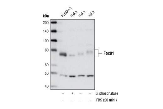Western blot analysis of extracts from IGROV-1 cells and untreated, λ phosphatase- or FBS-treated (20 min.) HeLa cells using FoxO1 (L27) Antibody.