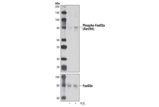 Western blot analysis of extracts from C2C12 cells, untreated or H 2 O 2 treated, using Phospho-FoxO3a (Ser294) Antibody (upper) or FoxO3a (75D8) Rabbit mAb #2497 (lower).