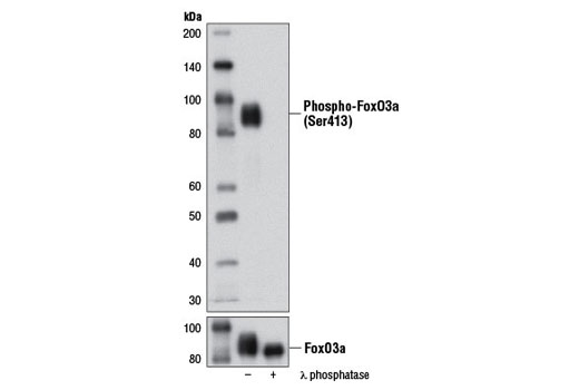 Western blot analysis of extracts from 293T cells transfected with FoxO3a, untreated (-) or treated with λ phosphatase (+), using Phospho-FoxO3a (Ser413) (D77C9) Rabbit mAb (upper) and FoxO3a (75D8) Rabbit mAb #2497 (lower).