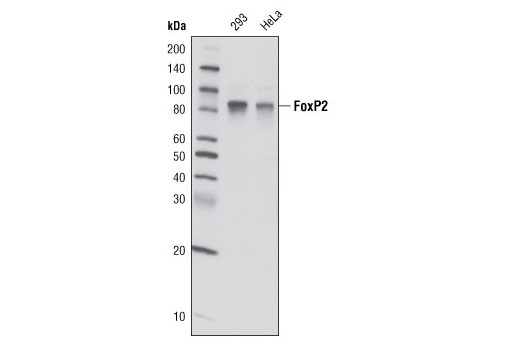 Western blot analysis of extracts from 293 and HeLa cells using FoxP2 (D55H9) Rabbit mAb.