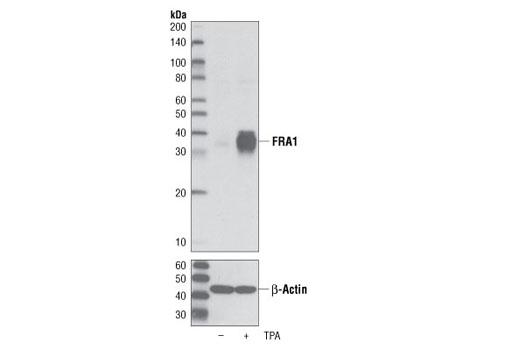 Western blot analysis of extracts from serum-starved HeLa cells, untreated or stimulated with TPA #4174 for 4 hours, using FRA1 (D80B4) Rabbit mAb (upper) and β-Actin Antibody #4967 (lower).