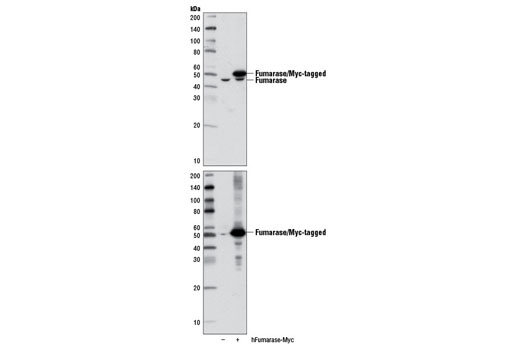 Western blot analysis of extracts from 293 cells, untransfected (-) or transfected with a Myc-tagged cDNA expression construct encoding human fumarase (hFumarase-Myc; +), using Fumarase (D9C5) Rabbit mAb (upper) and Myc-Tag (71D10) Rabbit mAb #2278 (lower).