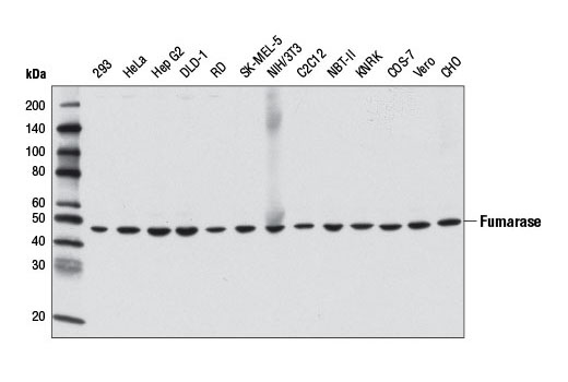 Western blot analysis of extracts from various cell lines using Fumarase (D9C5) Rabbit mAb.