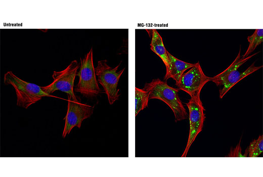 Confocal immunofluorescent analysis of C2C12 cells, untreated (left) or MG-132 treated (10 μg/mL, 3 hr; right), using FXR1 (D10A2) XP ® Rabbit mAb (green). Actin filaments were labeled with DY-554 phalloidin (red). Blue pseudocolor = DRAQ5 ® #4084 (fluorescent DNA dye).