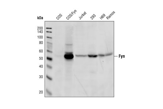 Western blot analysis of cell extracts from various cell lines, using Fyn Antibody.