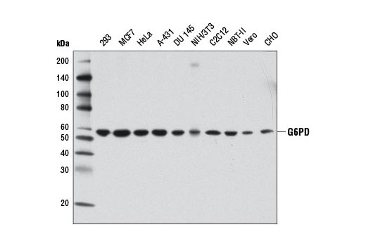 Western blot analysis of extracts from various cell lines using G6PD (D5D2) Rabbit mAb.