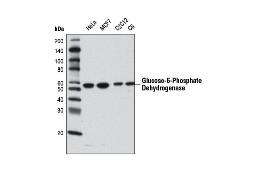 Western blot analysis of extracts from various cell lines using Glucose-6-Phosphate Dehydrogenase Antibody.