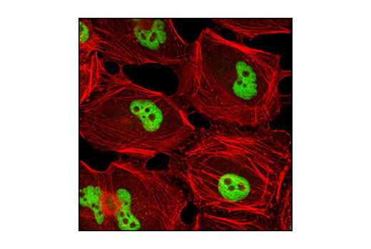 Confocal immunofluorescent analysis of HeLa cells using G9a/EHMT2 (C6H3) Rabbit mAb (green). Actin filaments have been labeled with DY-555 phalloidin (red).