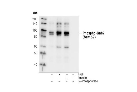 Western blot analysis of extracts from H-4-II-E cells, untreated, HGF-treated, insulin-treated or treated with lambda phosphatase after lysis, using Phospho-GAB2 (Ser159) Antibody.