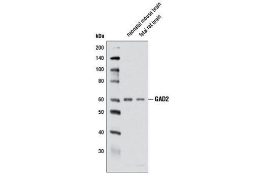 Western blot analysis of extracts from neonatal mouse and fetal rat brain using GAD2 (D5G2) XP ® Rabbit mAb.