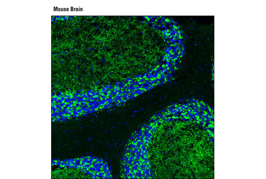 Confocal immunofluorescent analysis of mouse brain using GAD2 (D5G2) XP ® Rabbit mAb (green). Blue pseudocolor = DRAQ5 ® #4084 (fluorescent DNA marker).
