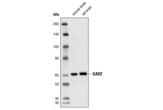 Western blot analysis of extracts from mouse and rat brain using GAD2 Antibody.