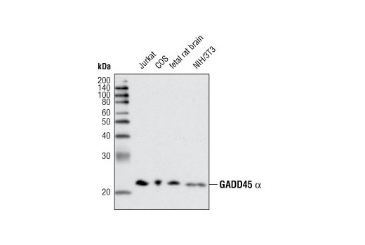 Western blot analysis of extracts from various cell lines and tissues using GADD45 alpha (D17E8) Rabbit mAb.