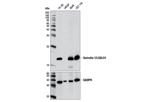 Western blot analysis of extracts from various cell lines using Galectin-1/LGALS1 (D6O8T) Rabbit mAb (upper) and GAPDH (D16H11) Rabbit mAb #5174 (lower). The LNCap cell line extract is negative for galectin-1/LGALS1 expression as expected.