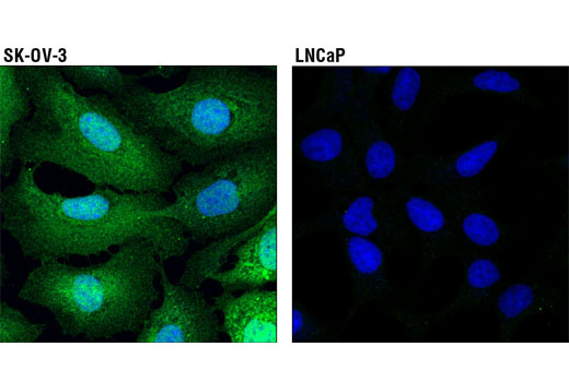 Confocal immunofluorescent analysis of SK-OV-3 (positive, left) and LNCaP (negative, right) cells, using Galectin-1/LGALS1 (D6O8T) Rabbit mAb (green). Blue pseudocolor= DRAQ5 ® #4084 (fluorescent DNA dye).