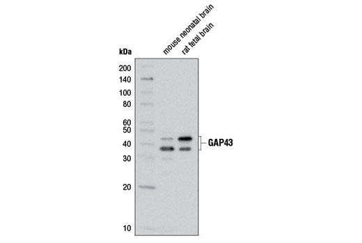 Western blot analysis of extracts from mouse neonatal brain and rat fetal brain using GAP43 (D9C8) Rabbit mAb.