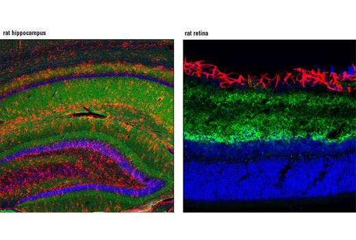 Confocal immunofluorescent analysis of rat hippocampus (left) and retina (right) using GAP43 (D9C8) Rabbit mAb (green) and GFAP (GA5) Mouse mAb (Alexa Fluor ® 555 Conjugate) #3656 (red). Blue pseudocolor = DRAQ5 ® #4084 (fluorescent DNA dye).