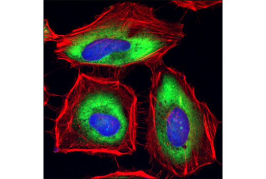 Confocal immunofluorescent analysis of HeLa cells using GAPDH (14C10) Rabbit mAb (green). Actin filaments have been labeled with Alexa Fluor ® 555 phalloidin (red). Blue pseudocolor = DRAQ5 ® #4084 (fluorescent DNA dye).
