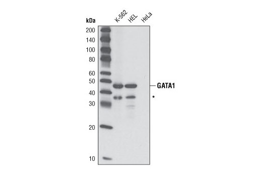 Western blot analysis of lysates from K-562, HEL and HeLa cells using GATA-1 (D24E4) XP ® Rabbit mAb. * putative GATA-1 fragment.