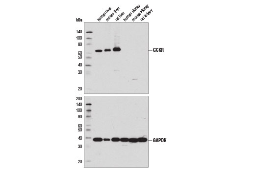 Western blot analysis of extracts from various liver (positive) and kidney (negative) samples using GCKR (D1W9P) Rabbit mAb (upper) and GAPDH (D16H11) XP ® Rabbit mAb #5174 (lower).