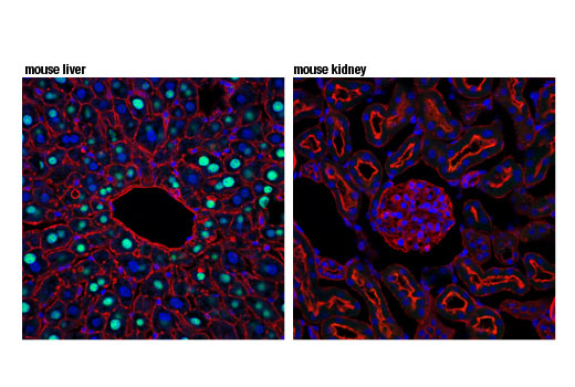 Confocal immunofluorescent analysis of mouse liver (positive, left) and mouse kidney (negative, right) using GCKR (D1W9P) Rabbit mAb (green). Actin filaments have been labeled with DyLight™ 554 Phalloidin #13054 (red). Blue pseudocolor = DRAQ5 ® #4084 (fluorescent DNA dye).
