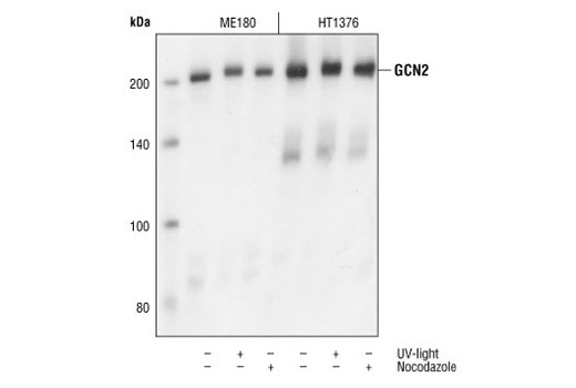 Western blot analysis of extracts from ME180 and HT1376 cells that were untreated, treated with UV light (50mJ/cm2, 30 minutes), or subjected to nocodazole block (50 ng/ml, 24hrs), using GCN2 Antibody.