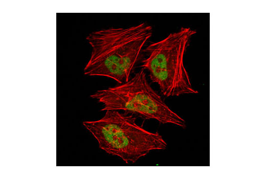 Confocal immunofluorescent analysis of HeLa cells using GCN5L2 (C26A10) Rabbit mAb (green). Actin filaments have been labeled with DY554 phalloidin (red). Blue pseudocolor = DRAQ5™ (fluorescent DNA dye).