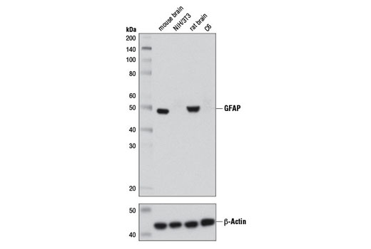 Western blot analysis of extracts from mouse brain, NIH/3T3 cells, rat brain, and C6 cells using GFAP (D1F4Q) XP ® Rabbit mAb (upper) or β-Actin (D6A8) Rabbit mAb #8457 (lower).
