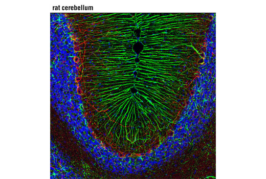 Confocal immunofluorescent analysis of rat cerebellum using GFAP (D1F4Q) XP ® Rabbit mAb (green) and Neurofilament-H (RMdO 20) Mouse mAb #2836 (red). Blue pseudocolor = DRAQ5 ® #4084 (fluorescent DNA dye).
