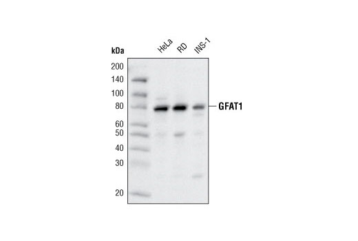 Western blot analysis of extracts from various cell types using GFAT1 (D12F4) Rabbit mAb.
