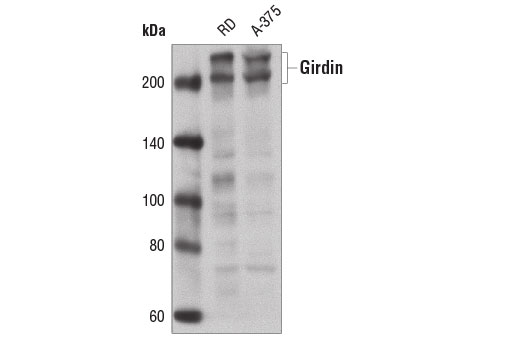 Western blot analysis of extracts from RD and A-375 cells using Girdin Antibody.