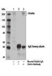 Immunoprecipitation of girdin protein from A-375 cell extracts using Normal Rabbit IgG #2729 (lane 2) or Girdin Antibody (lane 3). Lane 1 is 10% input. Western blot analysis was performed using Girdin Antibody.