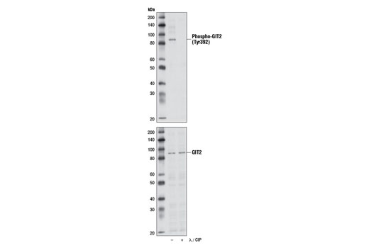 Western blot analysis of extracts from U-2 OS cells, untreated (-) or CIP and λ phosphatase-treated (+), using Phospho-GIT2 (Tyr392) (D8N9A) Rabbit mAb (upper) or GIT2 (D11B8) Rabbit mAb #8072 (lower).