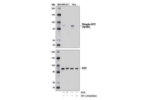 Western blot analysis of MDA-MB-231 cells, untreated (-) or EDTA-treated (0.05% in PBS, 7 min; +), and HeLa cell extracts, untreated (-) or CIP and λ phosphatase-treated (+), using Phospho-GIT2 (Tyr592) (D6L1J) Rabbit mAb (upper) or GIT2 (D11B8) Rabbit mAb #8072 (lower).