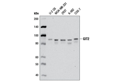 Western blot analysis of extracts from various cell lines using GIT2 Antibody.