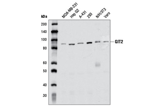 Western blot analysis of extracts from various cell lines using GIT2 (D11B8) Rabbit mAb.