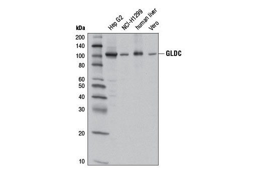 Western blot analysis of extracts from various tissues and cell lines using GLDC Antibody.