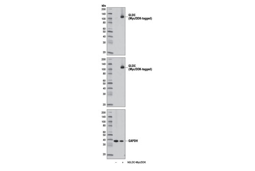 Western blot analysis of extracts from 293 cells, mock transfected (-) or transfected with a construct expressing Myc/DDK-tagged full-length human GLDC (hGLDC-Myc/DDK; +), using GLDC Antibody (upper), Myc-Tag (71D10) Rabbit mAb #2278 (middle), or GAPDH (D16H11) XP ® Rabbit mAb #5174 (lower).