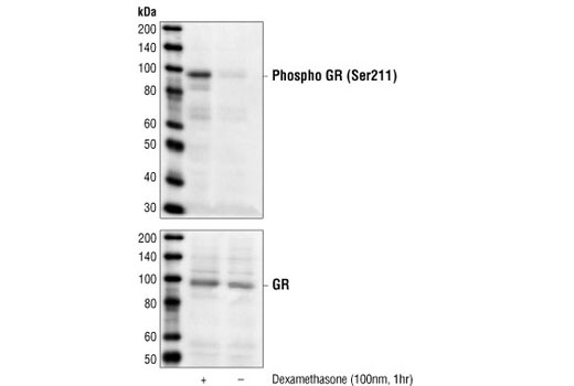 Western blot analysis of extracts from A549(CCL-185) cells, untreated or stimulated with dexamethasone (100 nM for 1 hr), using Phospho-Glucocorticoid Receptor (Ser211) Antibody (upper) or control glucocorticoid receptor antibody (lower).